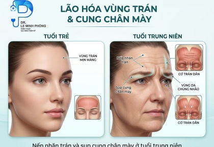 Căng Da Trán