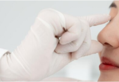 Nâng mũi bọc sụn tự thân