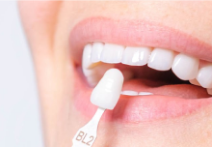 Thẩm mỹ nha khoa