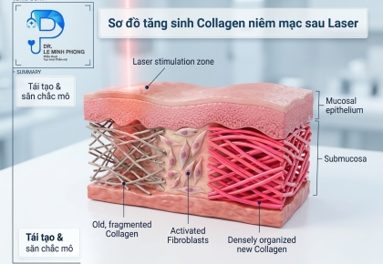 Trẻ Hóa Vùng Kín Laser