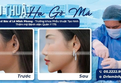 Hạ Gò Má