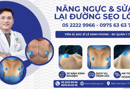 Ca nâng ngực kết hợp chỉnh sửa lại sẹo lồi cho khách hàng tại TPHCM 