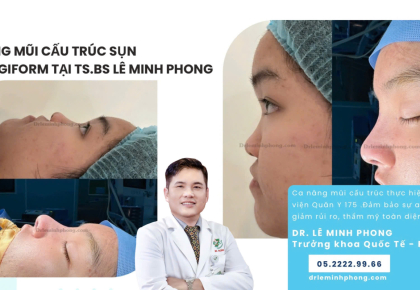 Mũi cấu trúc sụn SURGIFORM 