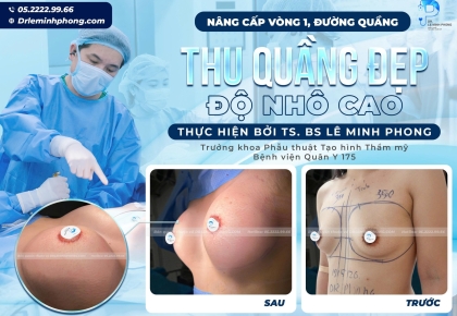 Thu Nhỏ Quầng Vú