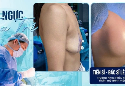 Treo Ngực Sa Trễ