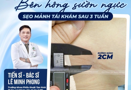 Đường Nâng 2cm Có Thật Sự Ít Đau Hơn Các Đường Mổ Truyền Thống?
