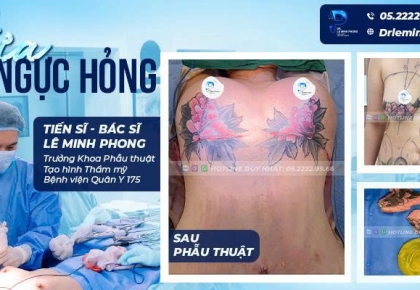 Sửa Ngực Hỏng