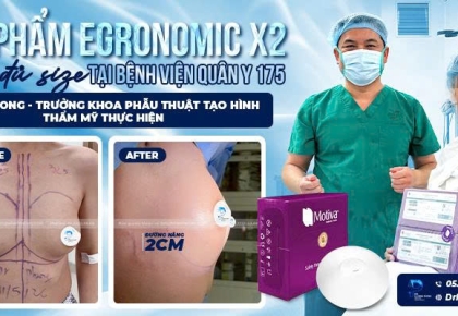 Nâng Ngực Ergonomix X2