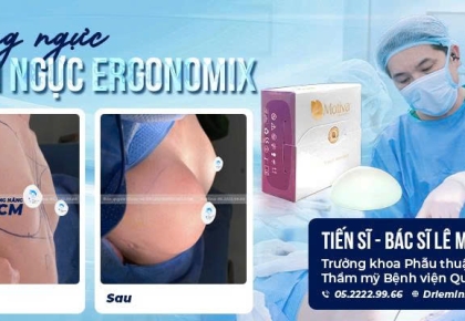 Nâng Ngực Ergonomix