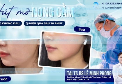 Hút Mỡ Nọng Cằm