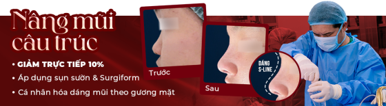 Nâng mũi cấu trúc