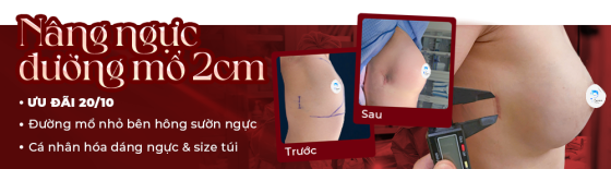Đường nâng bên hông sườn ngực chỉ 2cm