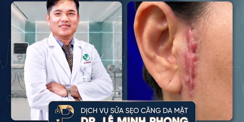 Sửa Sẹo Căng Da Mặt