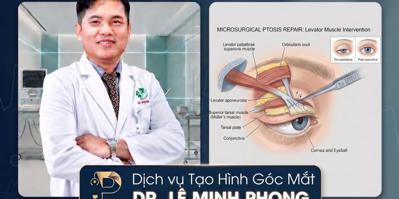 Tạo Hình Góc Mắt