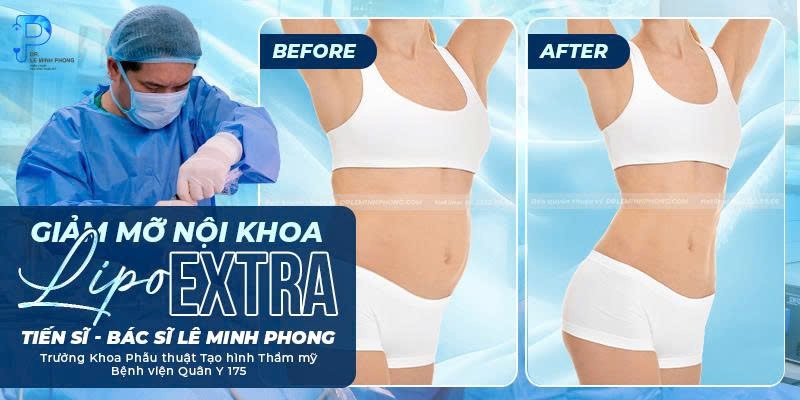 Giảm Mỡ Nội Khoa Lipo Extra