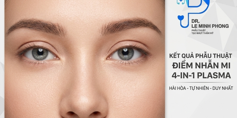 Cắt Mí 4 In 1 Plasma