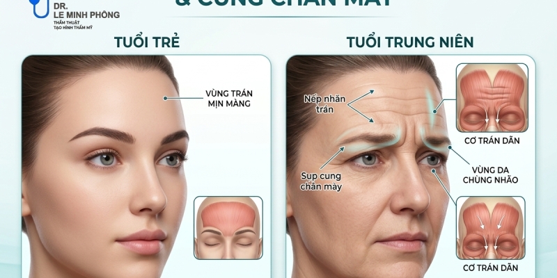 Căng Da Trán