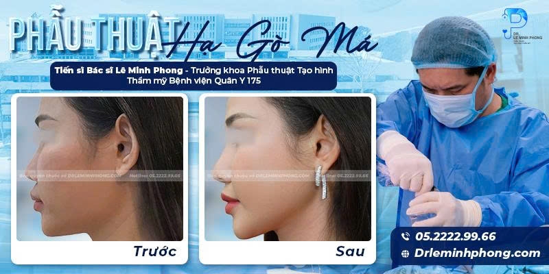 Hạ Gò Má
