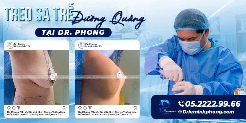Treo sa trễ đường quầng