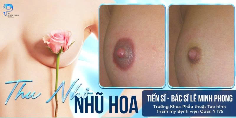 Làm Hồng Nhũ Hoa