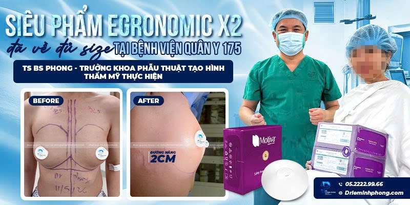Nâng Ngực Ergonomix X2
