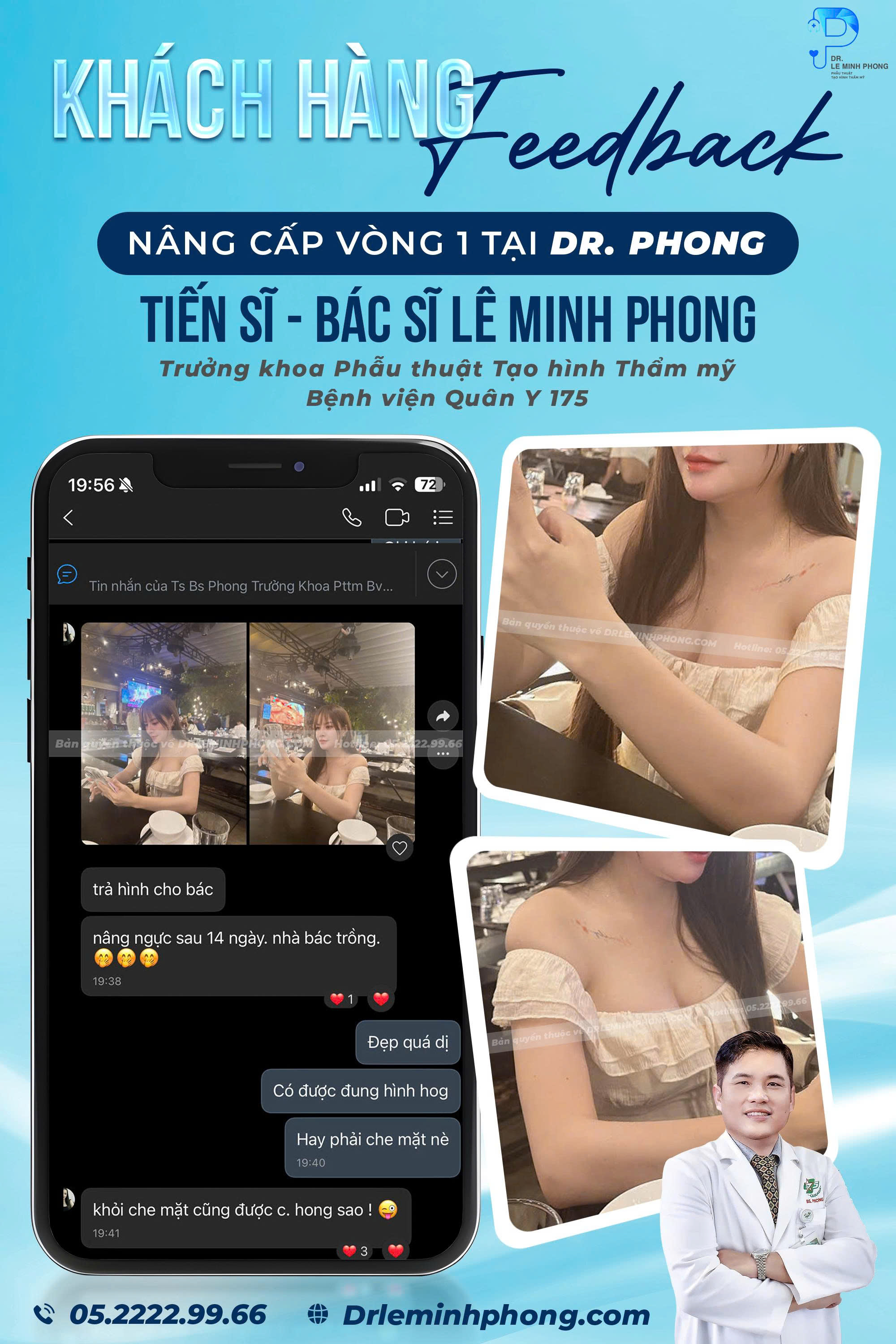 feedback-khach-hang-nang-cap-vong-1