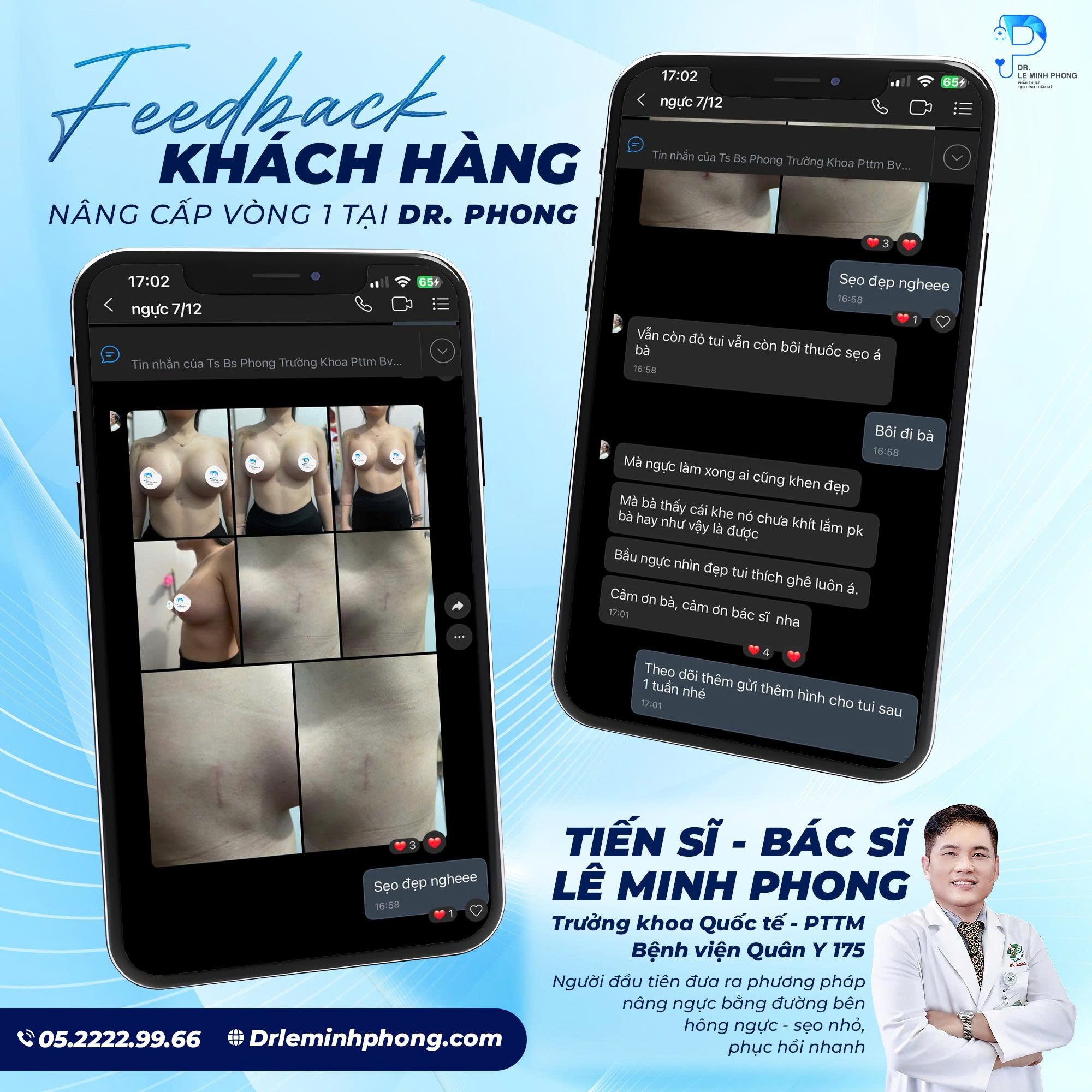 feedback-seo-manh-nang-nguc