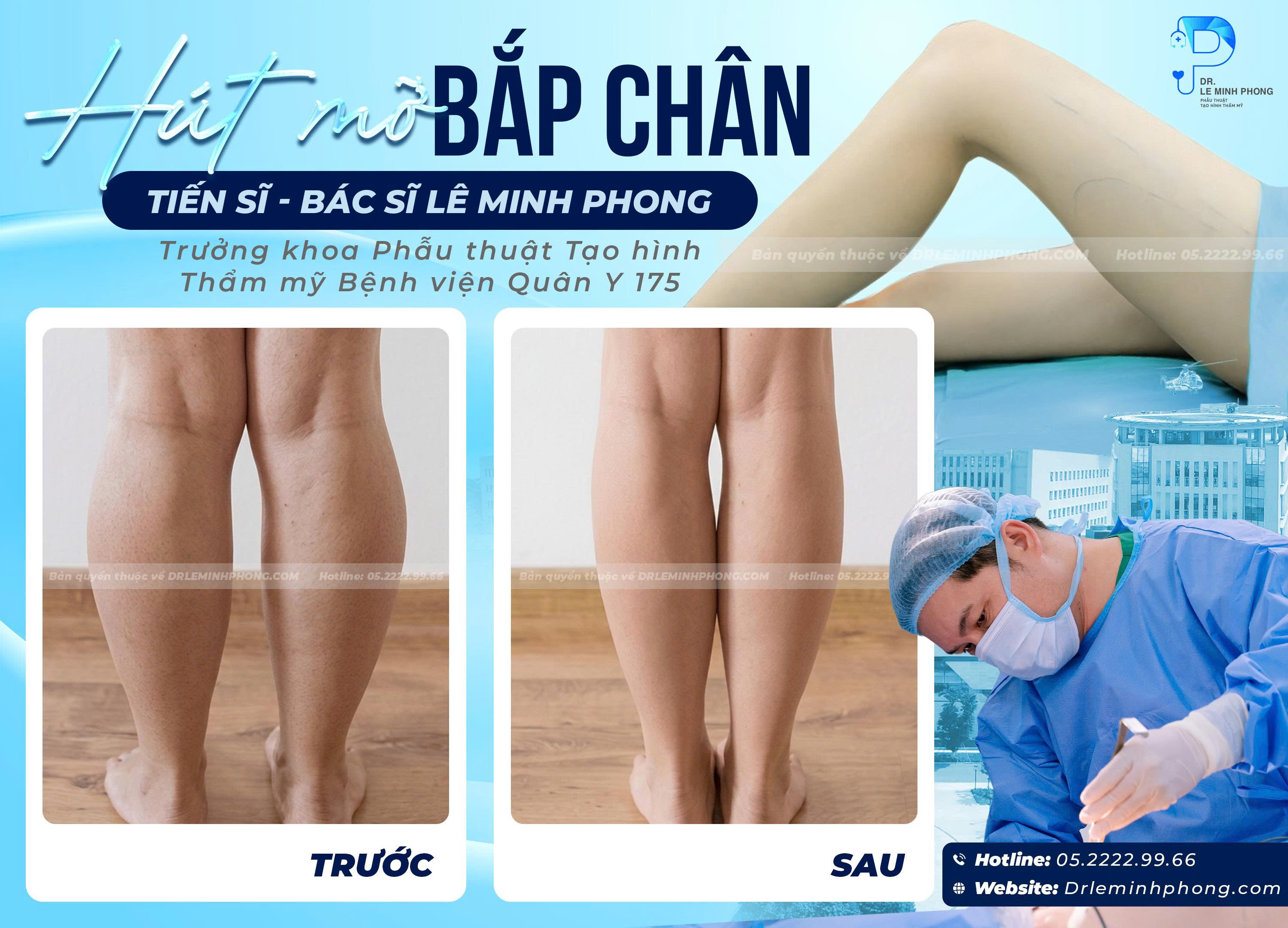 ket-qua-truoc-va-sau-hut-mo-bap-chan