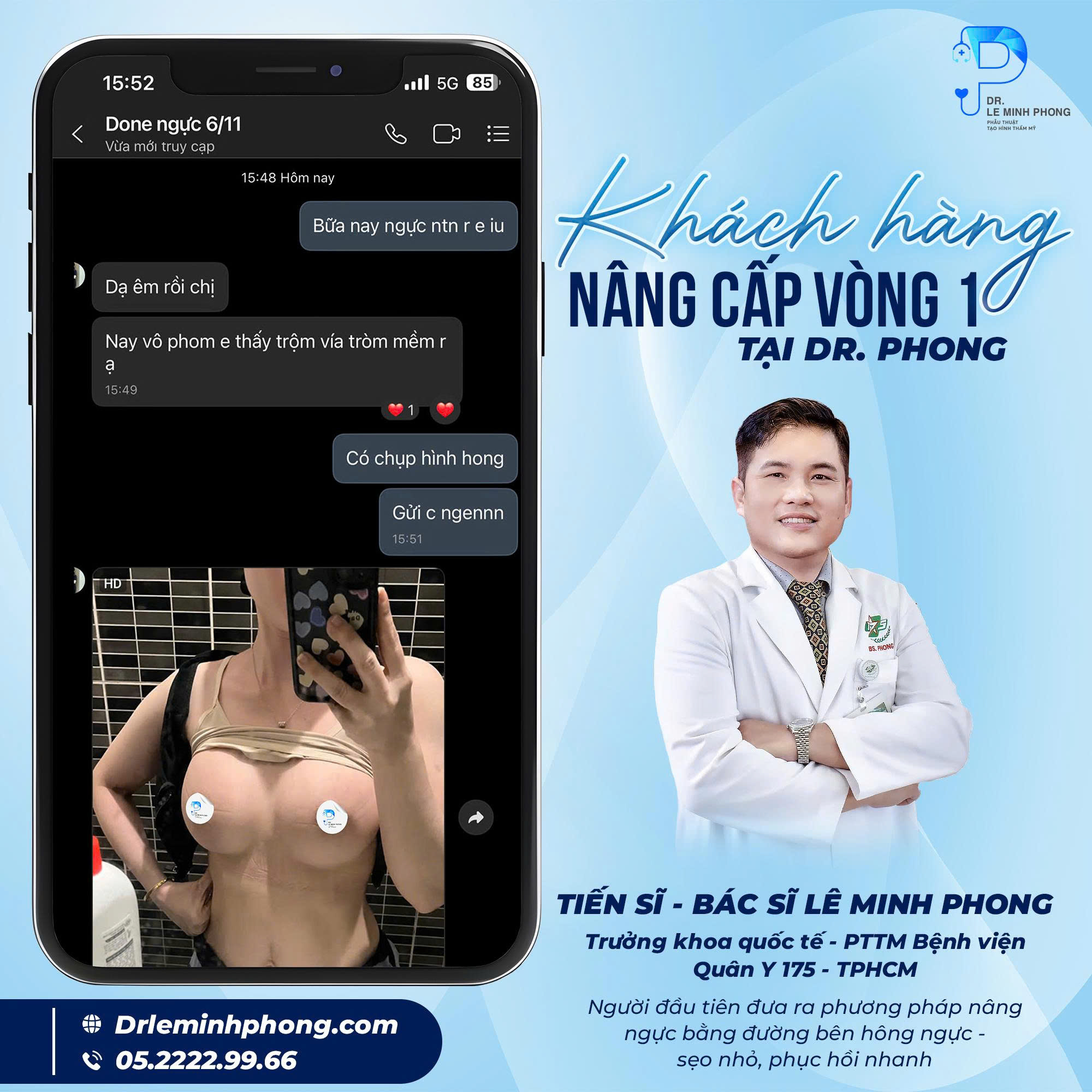 khach-hang-nang-cap-vong-1-tai-dr-phong