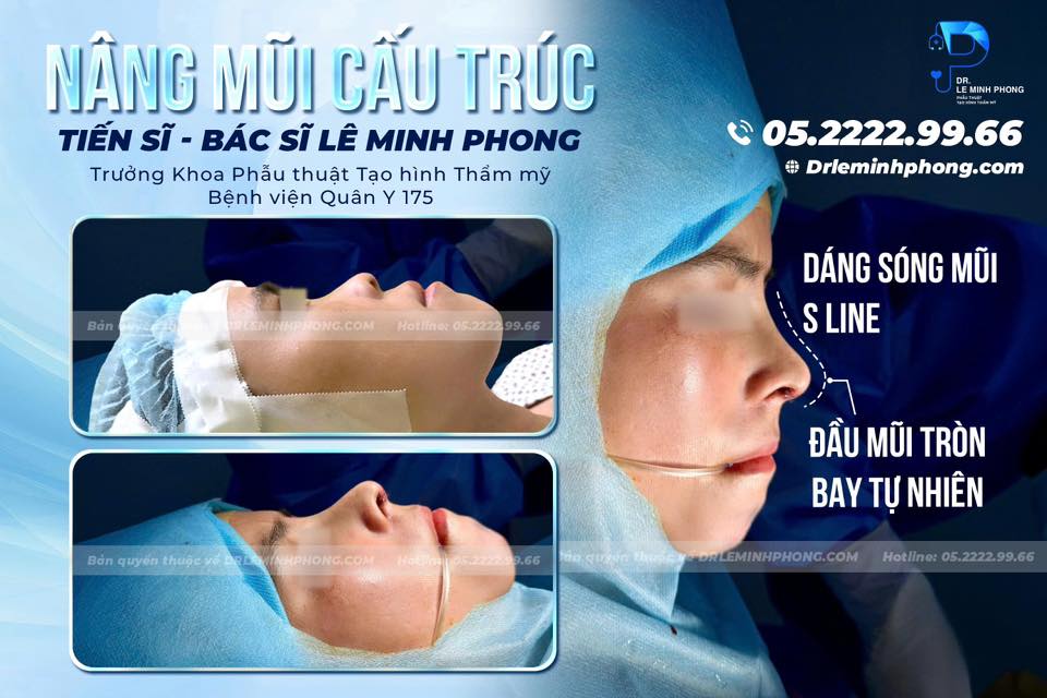 Nâng mũi cấu trúc - giải pháp toàn diện cho dáng mũi hoàn hảo