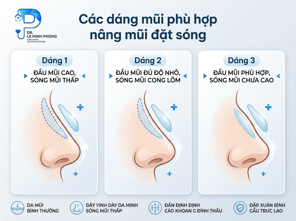 Dáng mũi phù hợp để thực hiện phương pháp nâng mũi thường đặt sóng