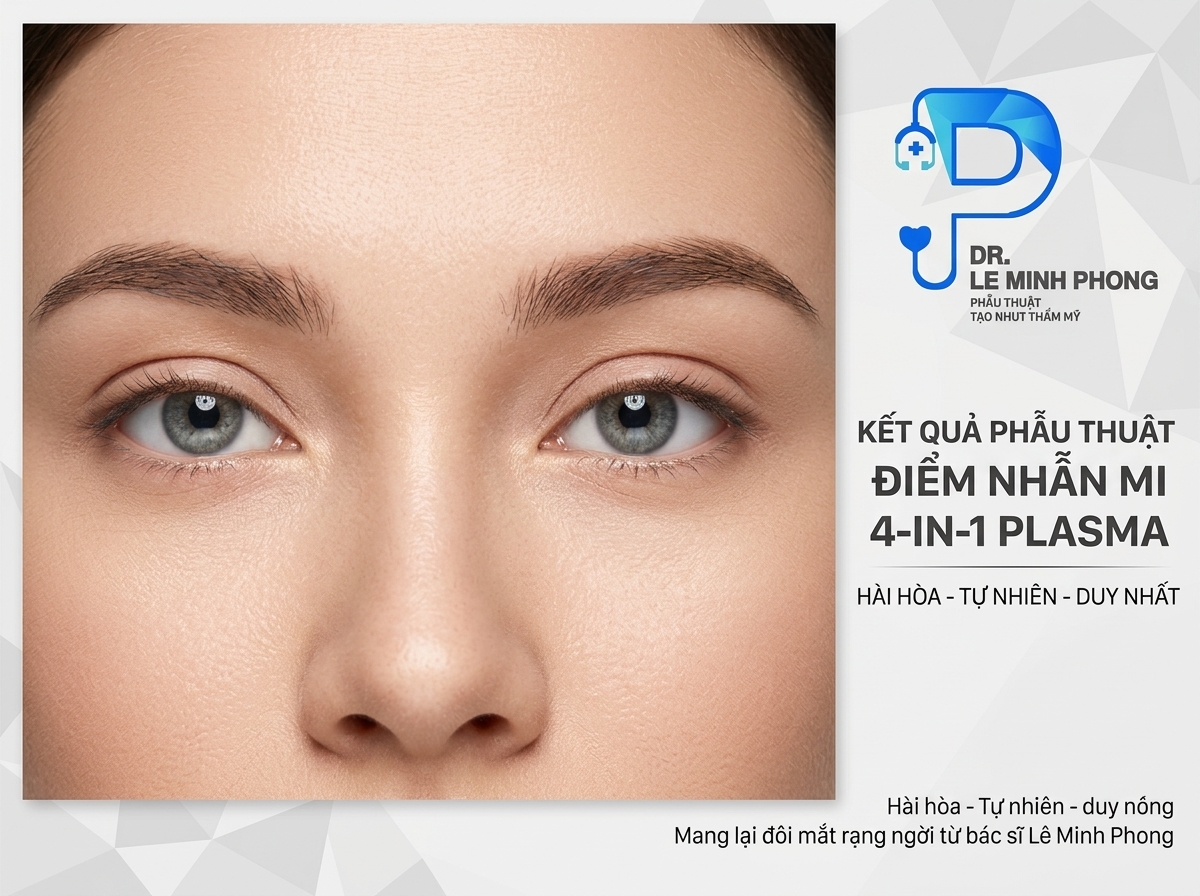 Đôi mắt hài hòa, tự nhiên - kết quả mong muốn của cắt mí 4 in 1 Plasma