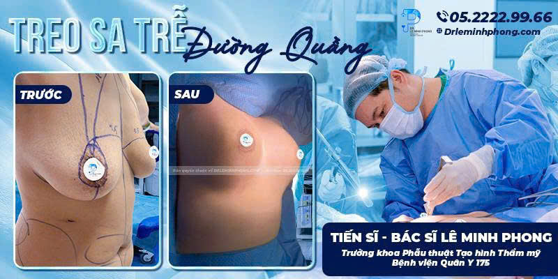 treo-sa-tre-duong-quang-dr-le-minh-phong