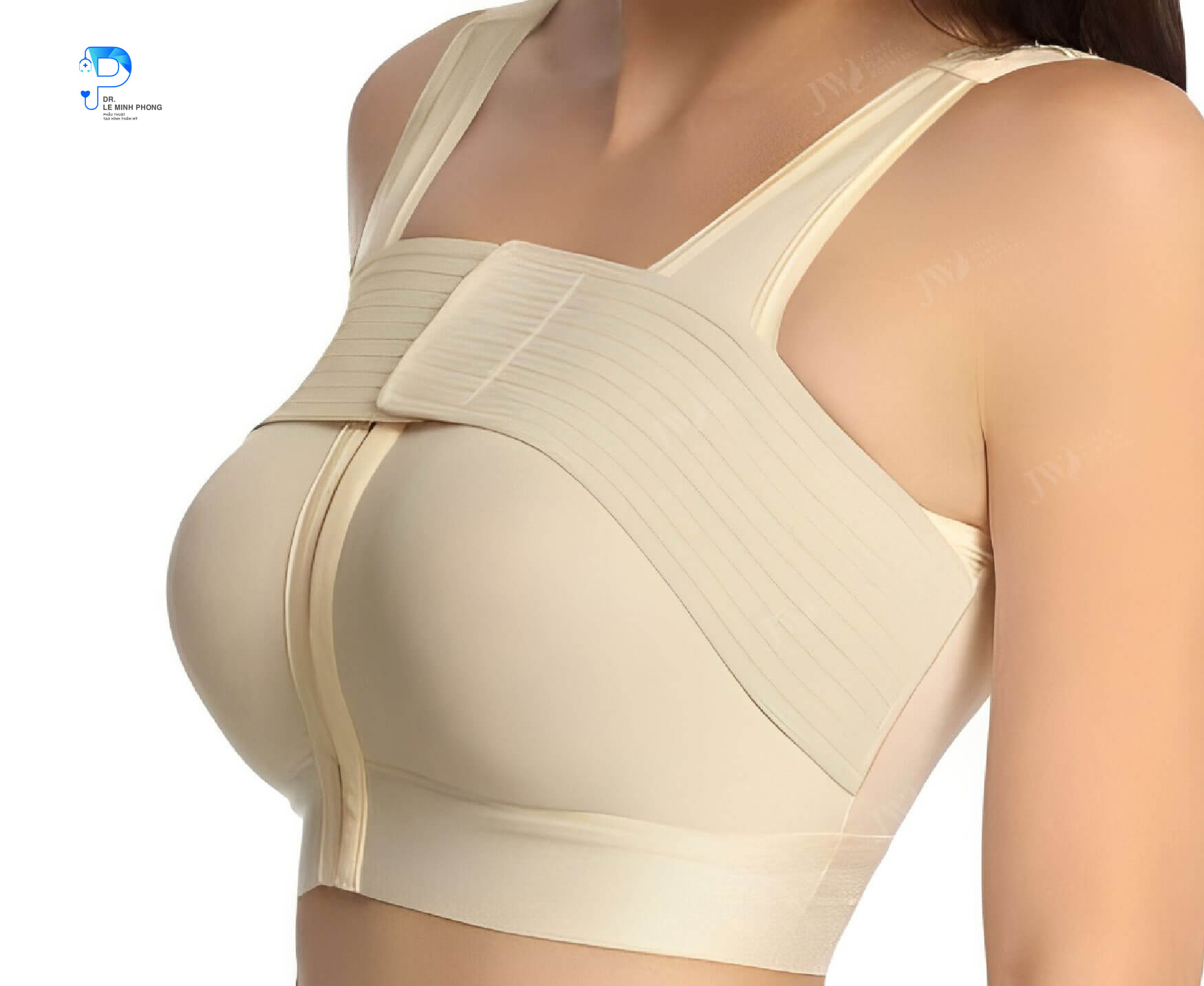 Khách hàng mặc áo định hình chuyên dụng sau khi phẫu thuật ngực phì đại sa trễ