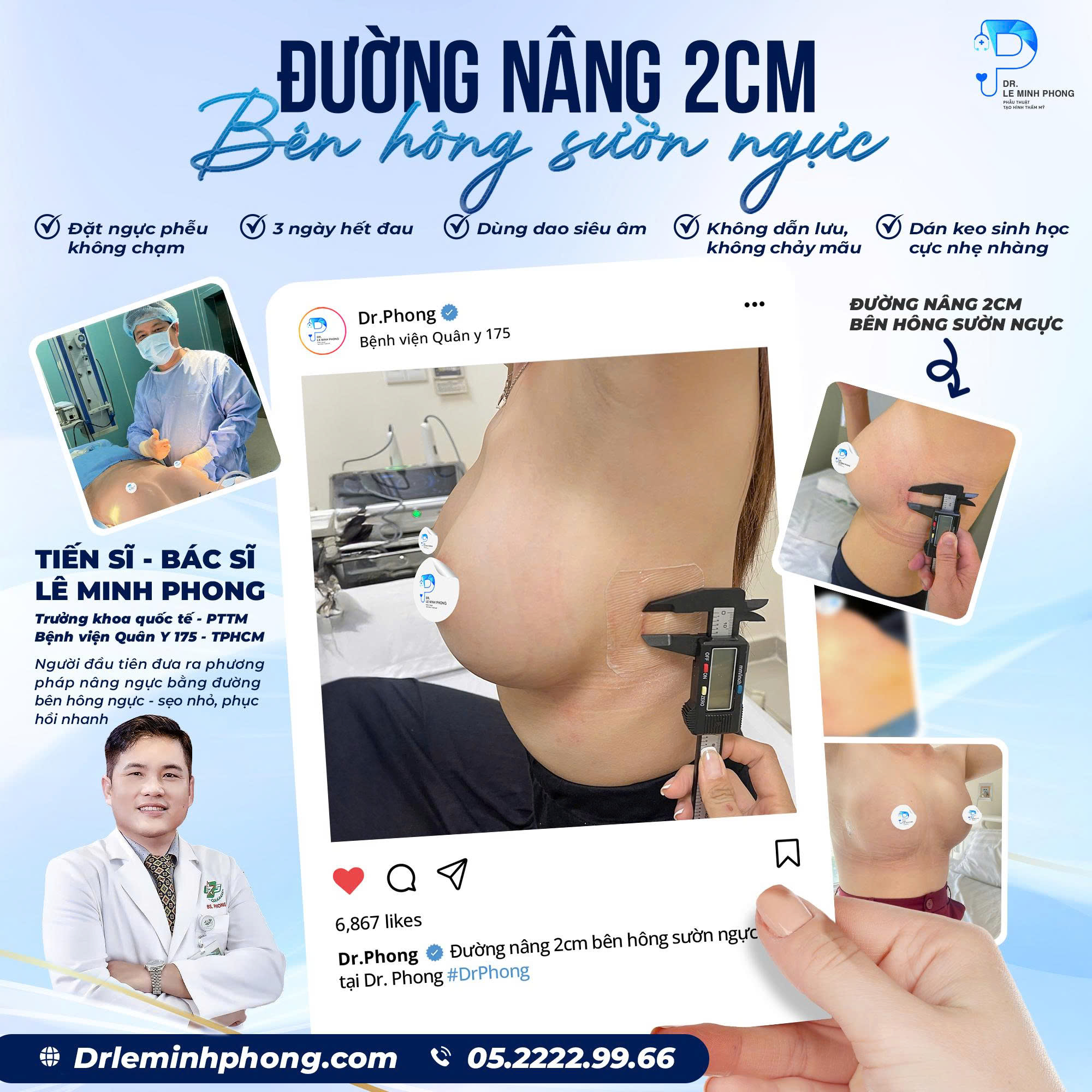 duong-nang-2cm-ben-hong-suon-nguc
