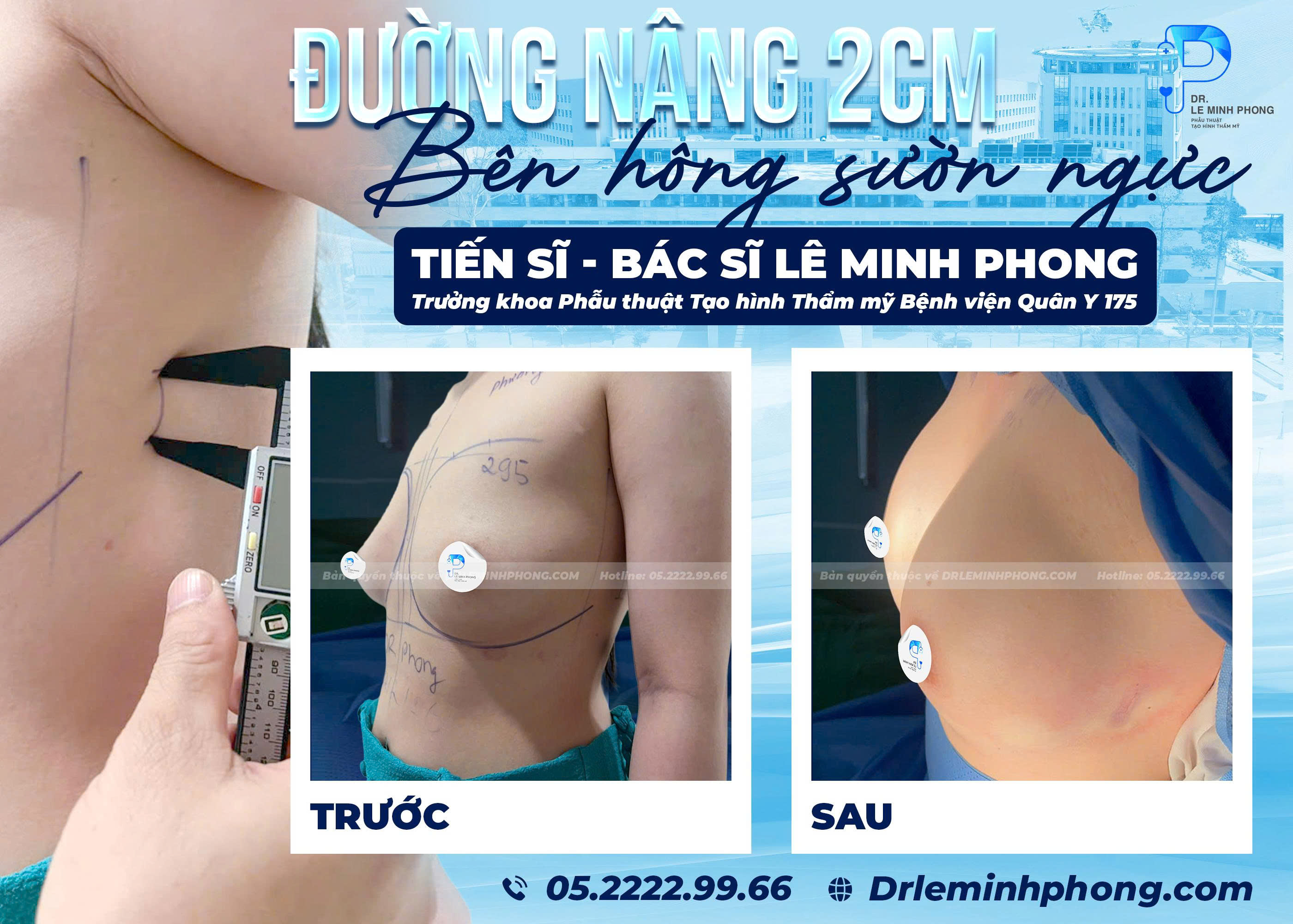 duong-nang-2cm-ben-hong-suon