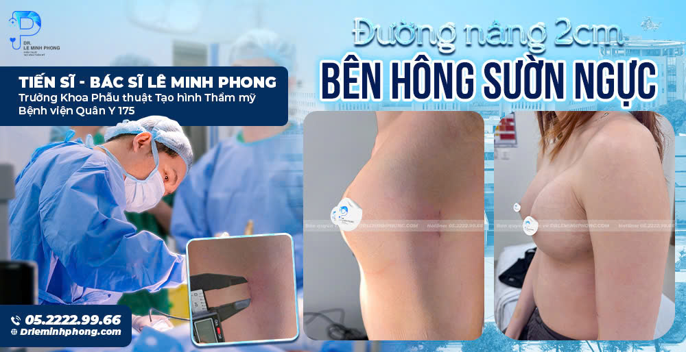 Minh họa chăm sóc sau nâng ngực với tư thế nằm ngửa và kê gối cao