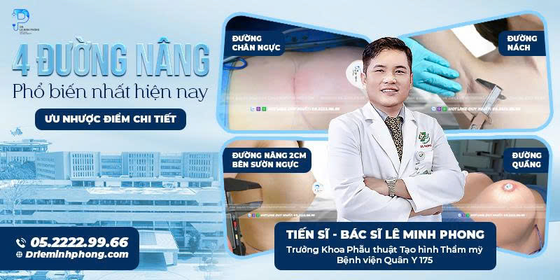 Bác sĩ tư vấn 4 đường nâng ngực phổ biến hiện nay cho khách hàng