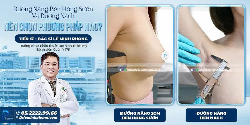 Đường nâng bên hông sườn và đường nách nên chọn phương pháp nào