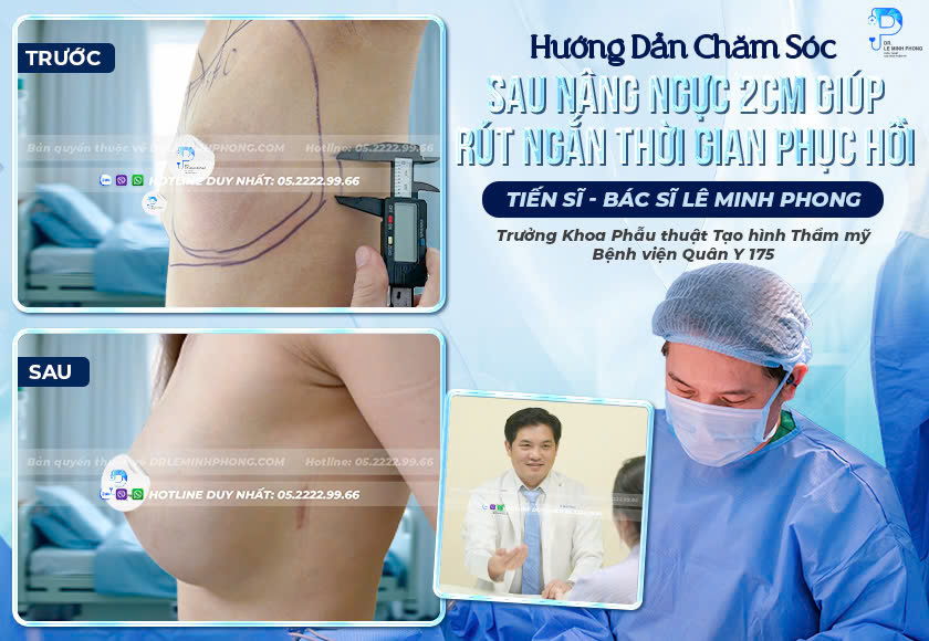 huong-dan-cham-soc-sau-nang-nguc-2cm-giup-rut-ngan-thoi-gian-phuc-hoi