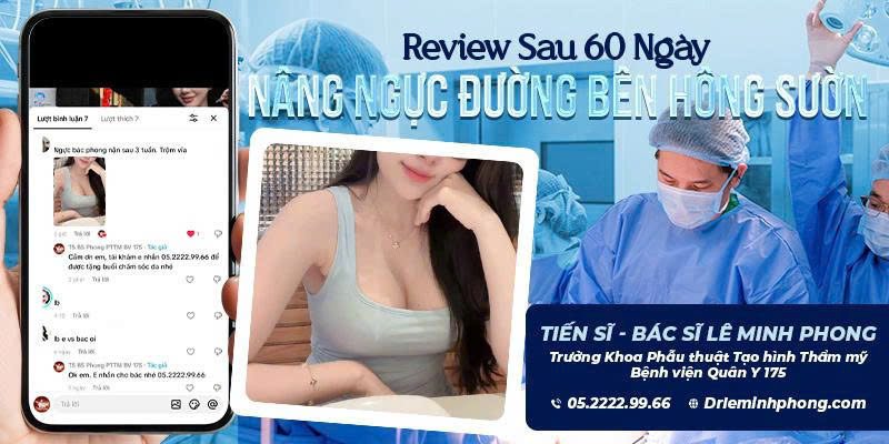 Hành trình 60 ngày hồi phục sau nâng ngực đường bên hông sườn ngực