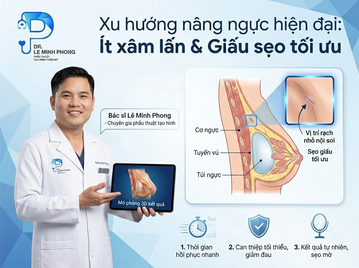 Xu hướng lựa chọn đường nâng bên hông sườn ngực hiện nay