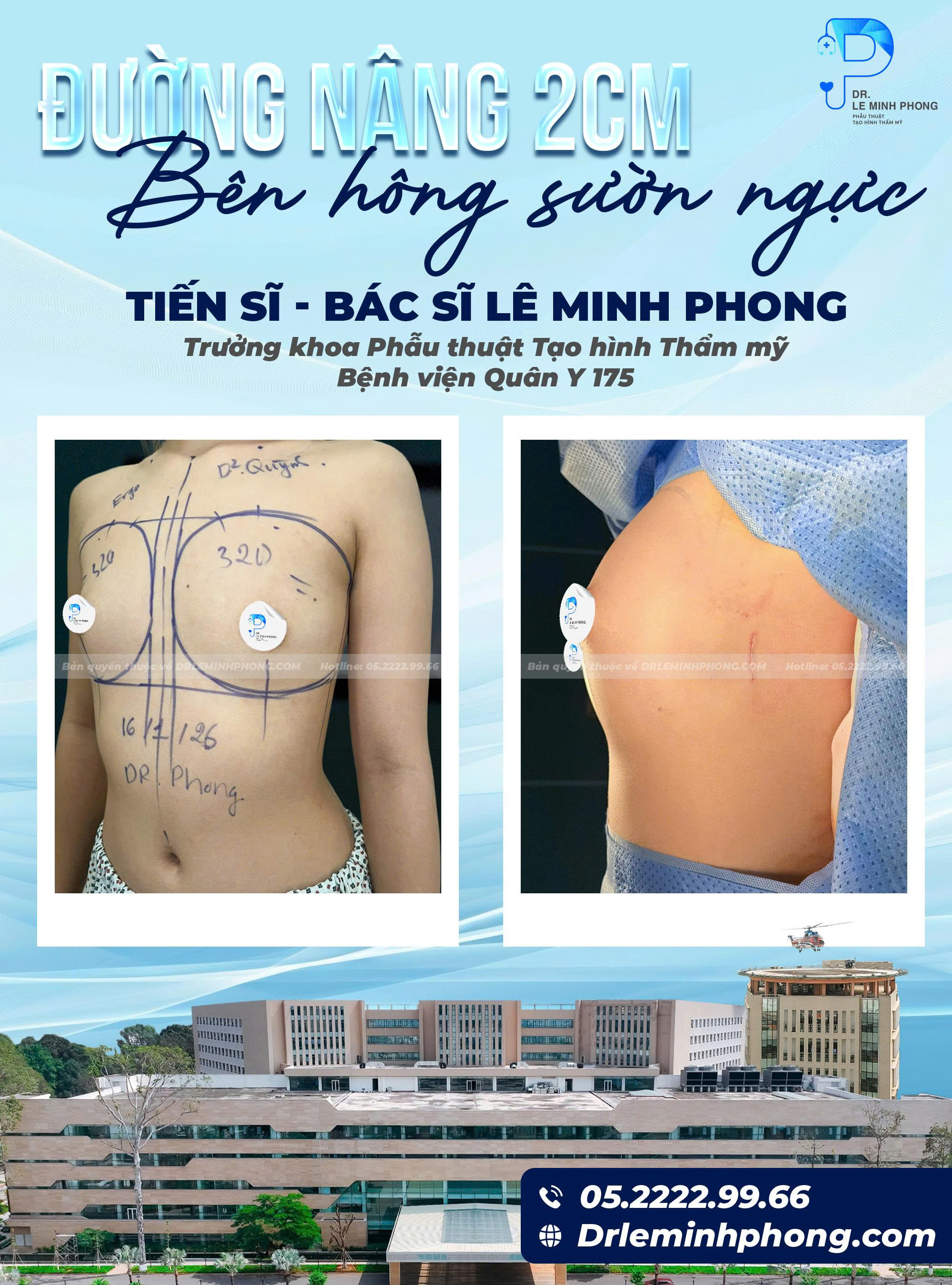 duong-nang-nguc-ben-hong-suon-nguc-giao-phau