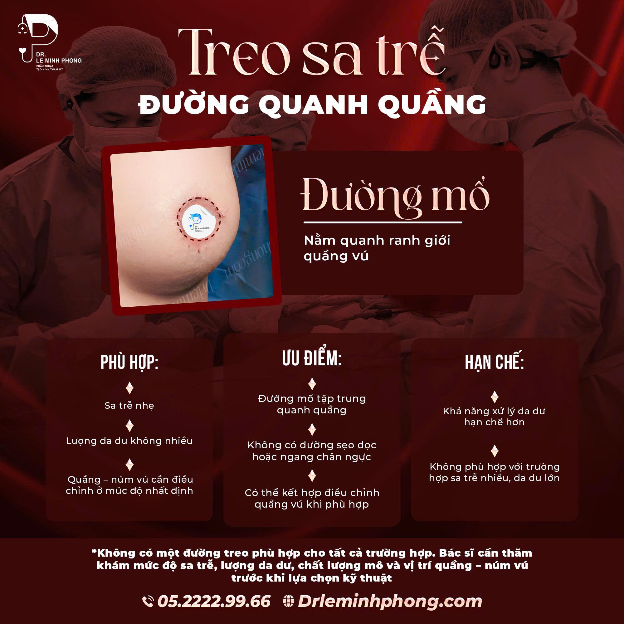 treo-sa-tre-duong-quang