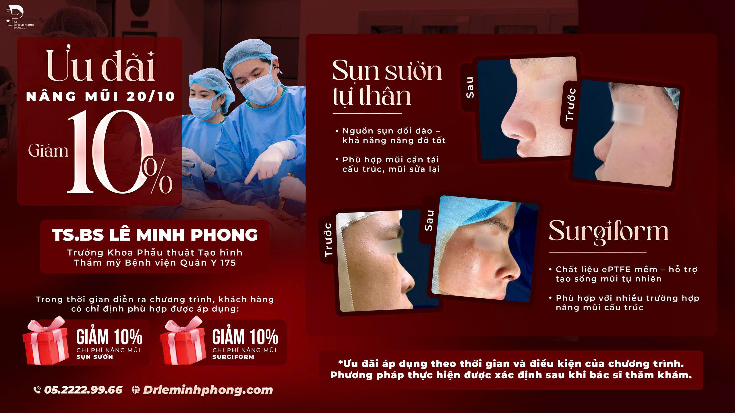 Phẫu thuật nâng mũi sụn sườn tự thân thực hiện bởi TS.BS Lê Minh Phong