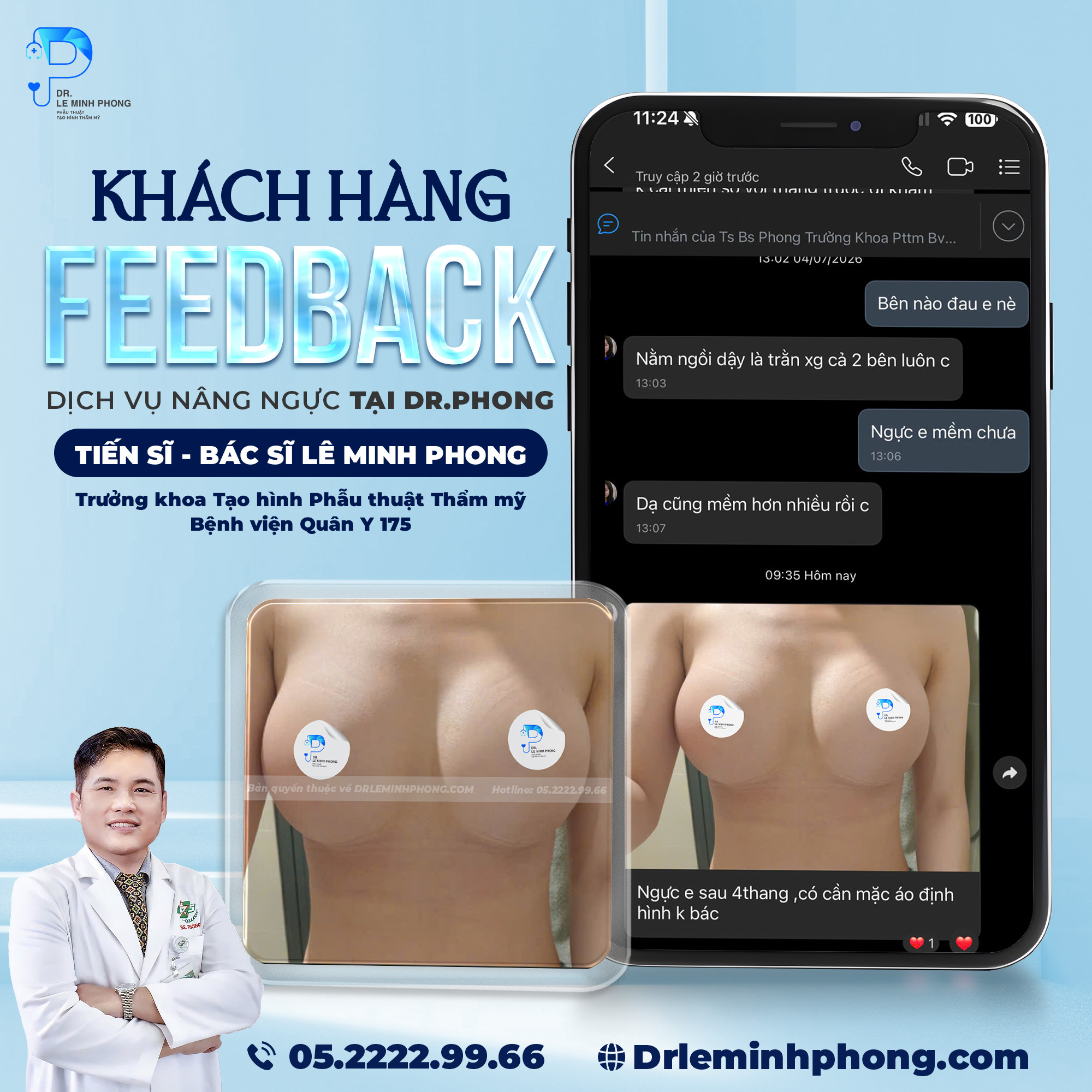 Feedback khách hàng nâng ngực sau 2 tuần tại Dr. Phong