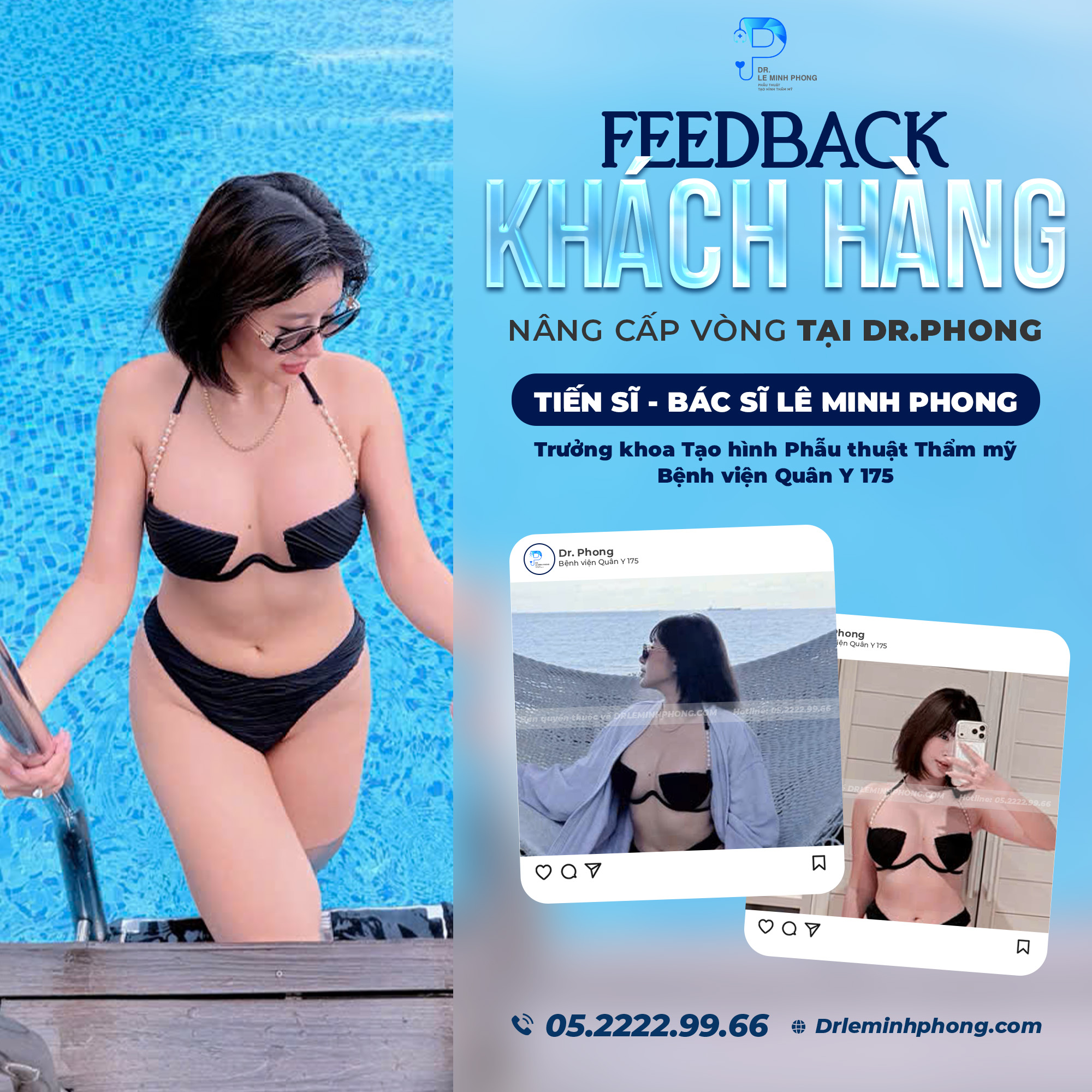 Feedback Nâng ngực an toàn – Sẵn sàng cho mùa du lịch biển