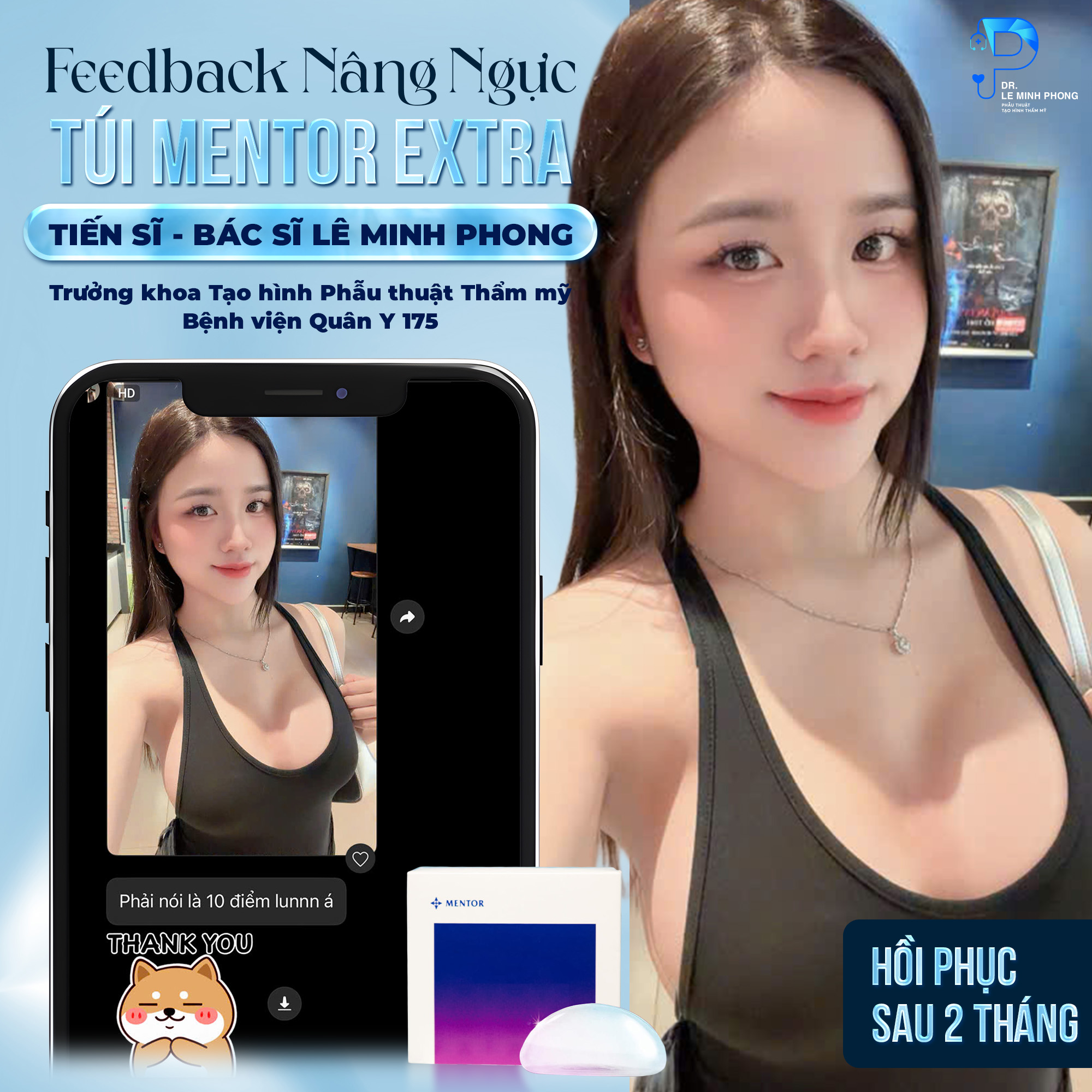 Feedback khách Nâng ngực túi Mentor Extra sau 2 tháng hồi phục