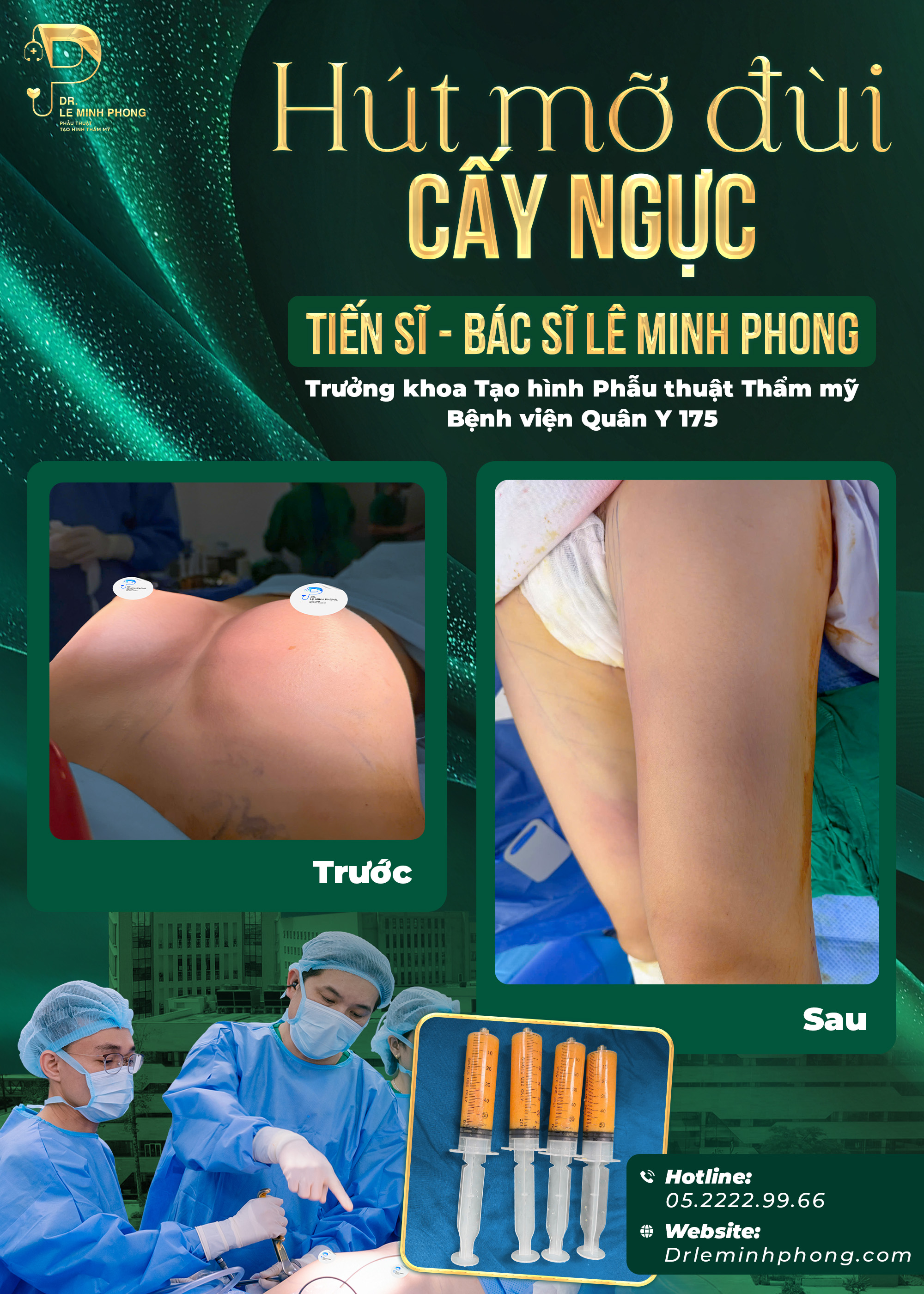 Hút Mỡ Đùi Và Cấy Mỡ Ngực Tự Thân Bởi TS.BS Lê Minh Phong