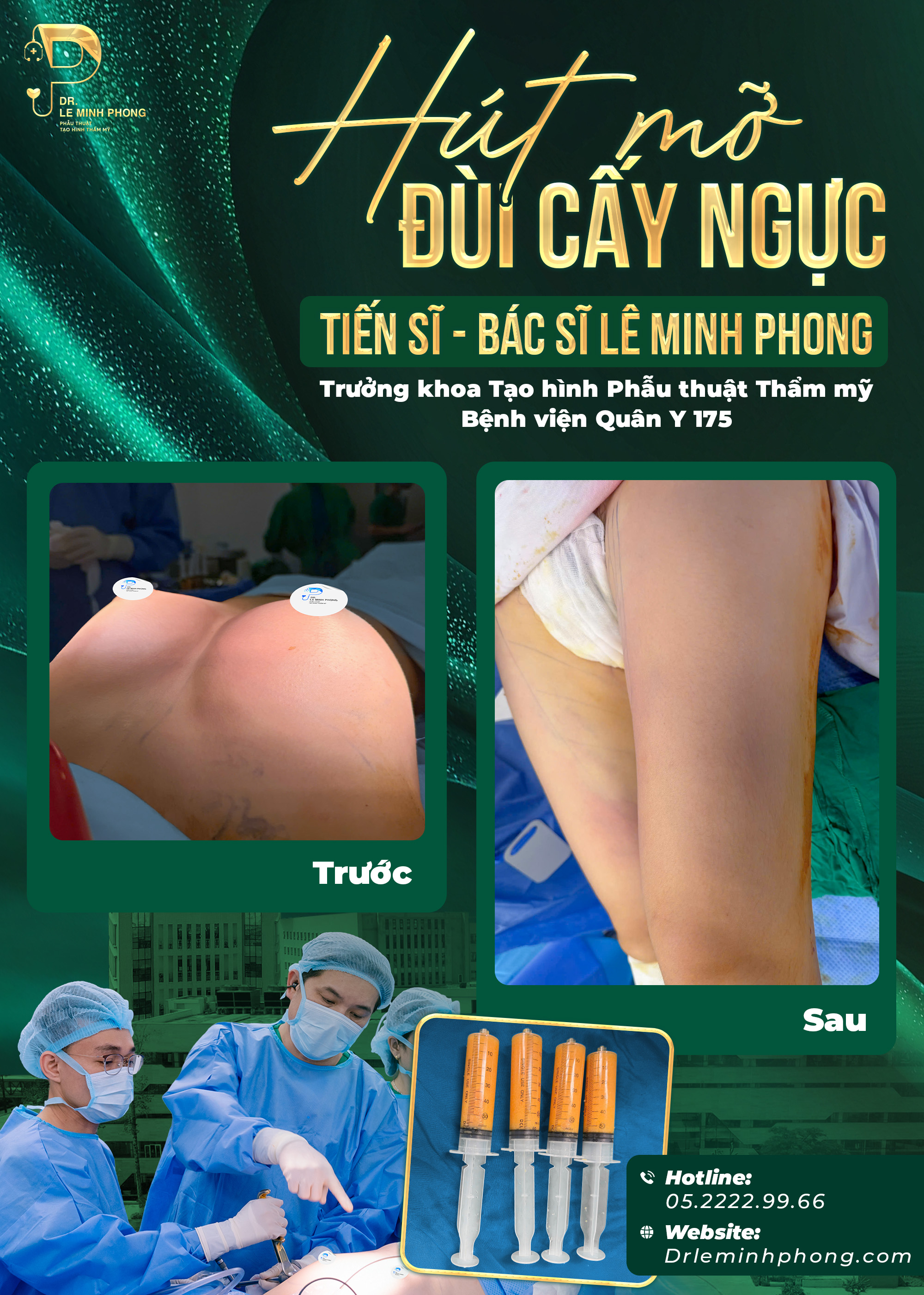Combo Hút mỡ Đùi kết hợp Cấy ngực